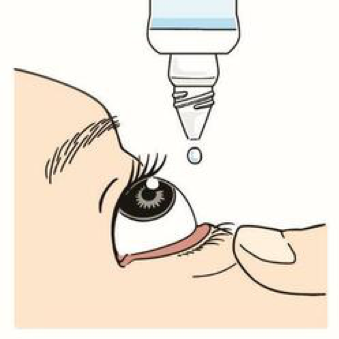 目薬 点眼液 眼軟膏 の使い方 参天製薬