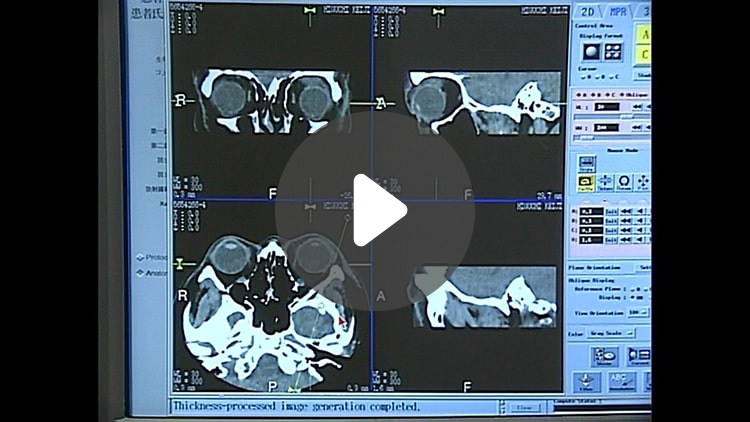 神経眼科関連の画像診断(CT．MRI)