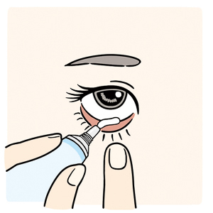眼軟膏の点眼方法②