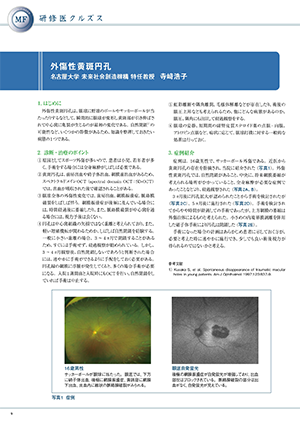 緑内障検査データの読み方・見方（２）視野／外傷性黄斑円孔